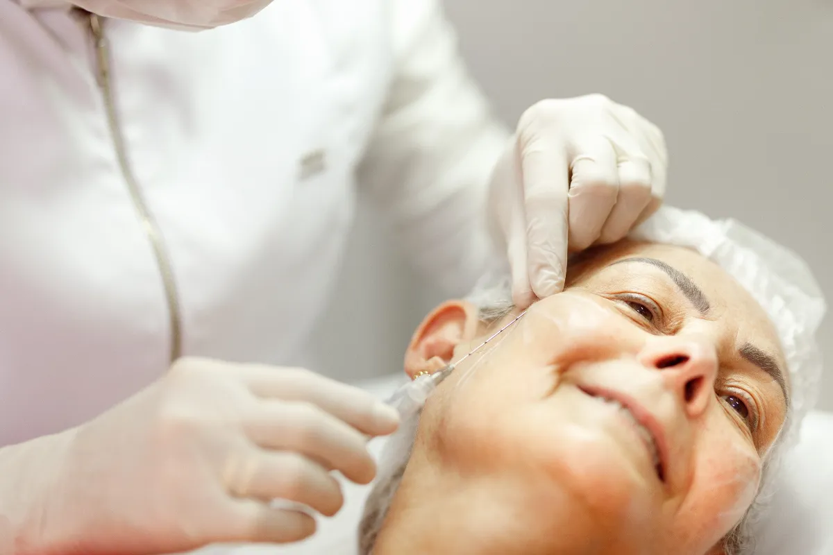 Biostimulator Sculptra o Radiesse
