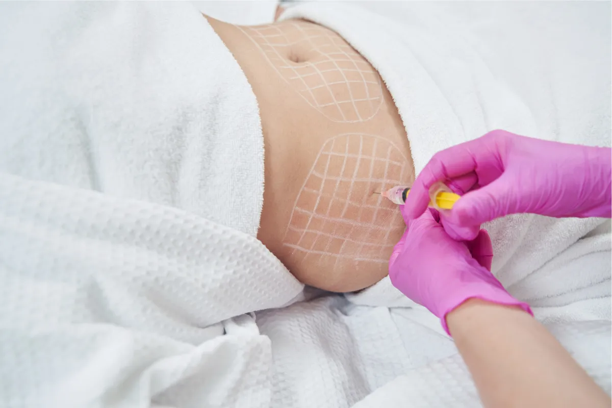 Lipo Shots