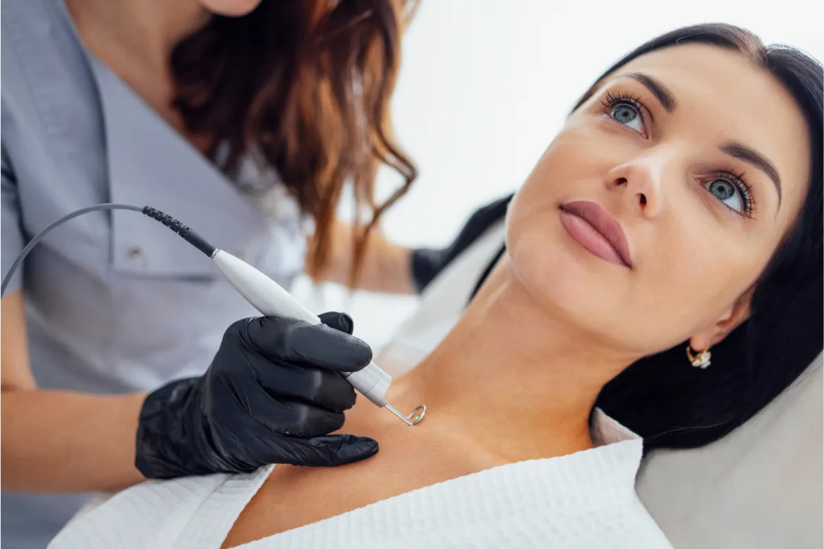 Wart and Mole Removal